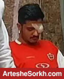 عمل جراحی دوباره بر چشم هوادار پرسپولیس